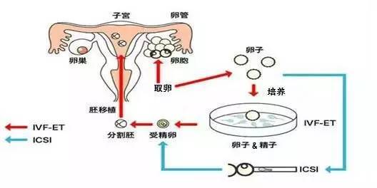 黑河捐卵费用